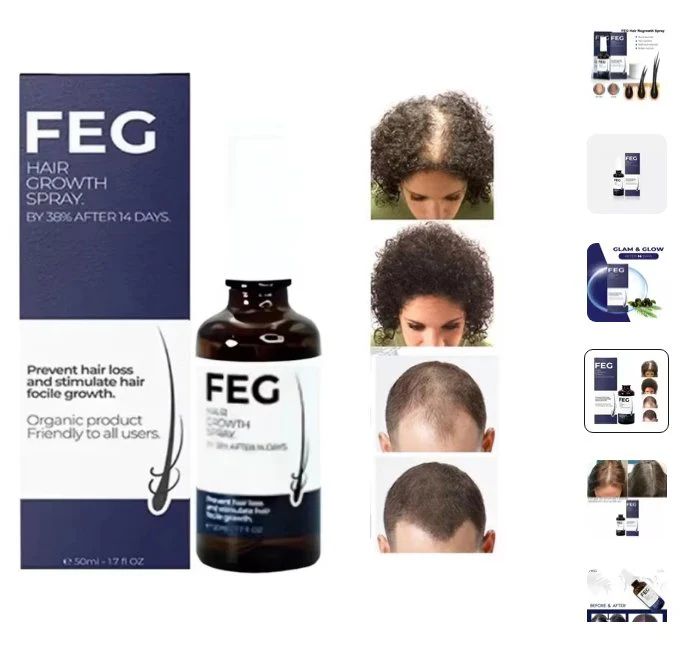 FEG Hair Growth Spray – Follicle Stimulating Formula