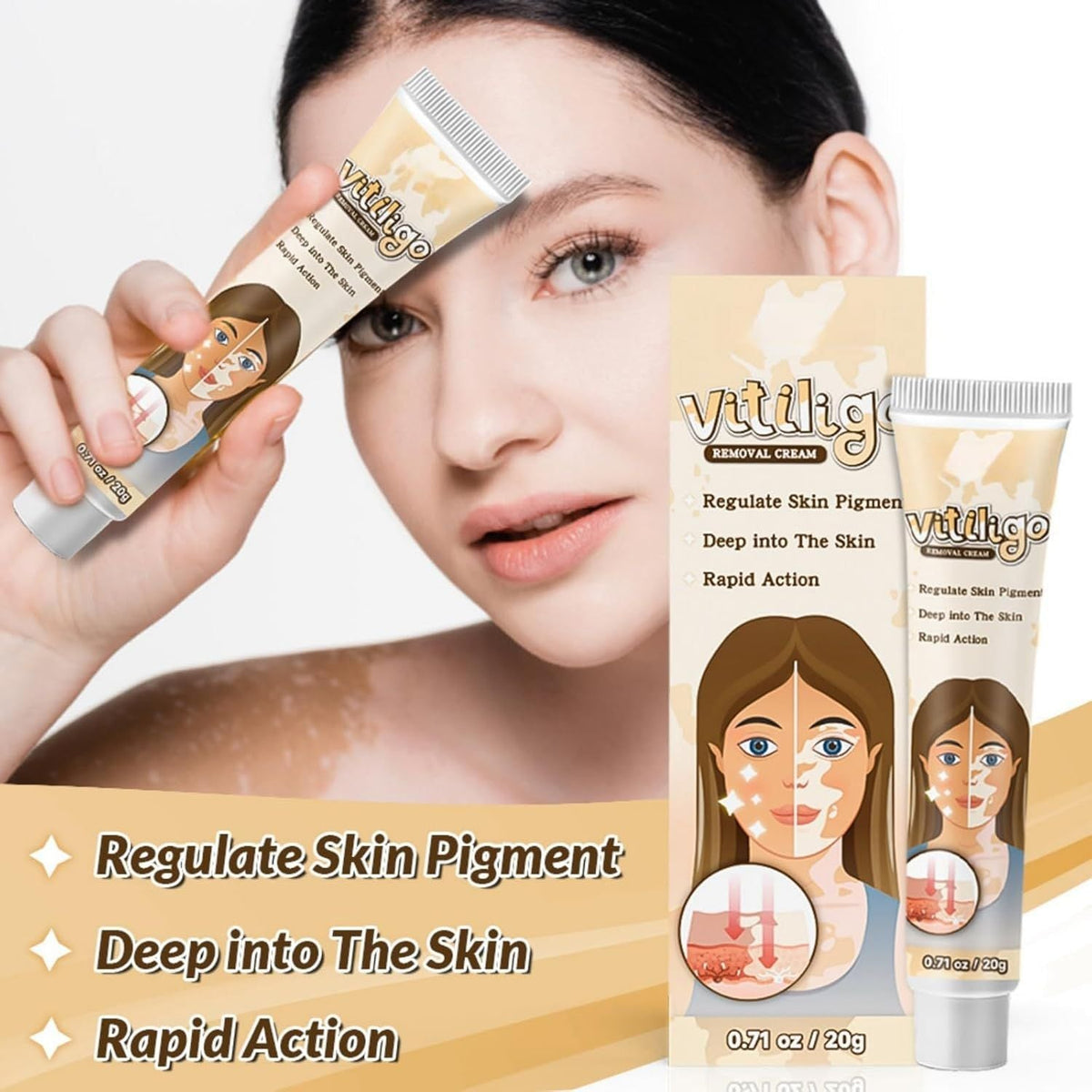 Vitiligo Removal Cream – Skin Tone Correcting Treatment