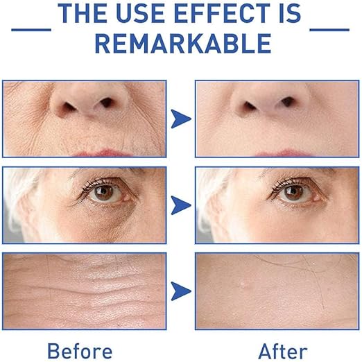 SADOER Retinol Caffeine Anti-Wrinkle Eye Cream – Hydrating Formula