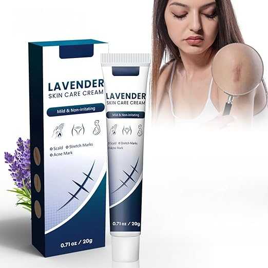 Lavender Skin Care Cream – Soothing Scar Healing Formula