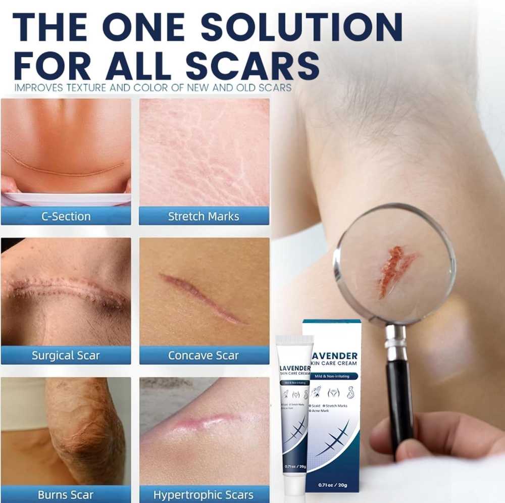 Lavender Skin Care Cream – Soothing Scar Healing Formula
