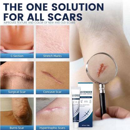 Lavender Skin Care Cream – Soothing Scar Healing Formula