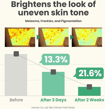 Dark Spot Correcting Cream – Brightening &amp; Hyperpigmentation Treatment