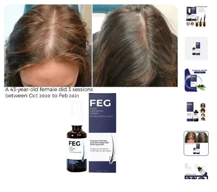 FEG Hair Growth Spray – Follicle Stimulating Formula