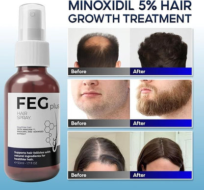 Hair Growth Spray PLUS – 5% Minoxidil Follicle Activator