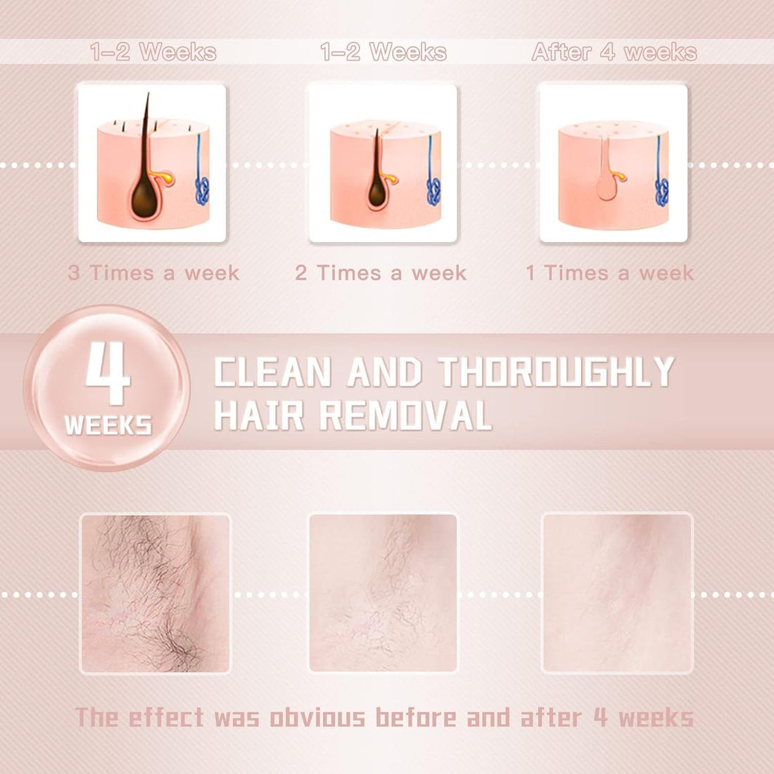 IPL Laser Hair Removal Device – For Women &amp; Men
