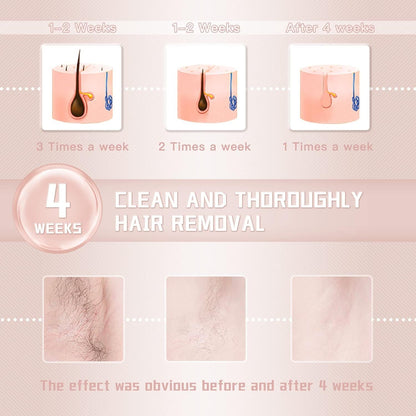 IPL Laser Hair Removal Device – For Women &amp; Men