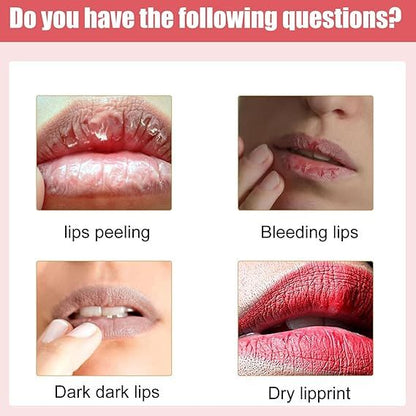 Lip Bleaching &amp; Moisturizing Cream Balm – Nourishing Lip Care