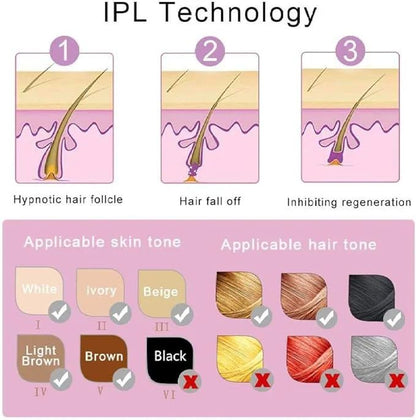 Mini IPL Laser Hair Removal Device – Compact &amp; Painless