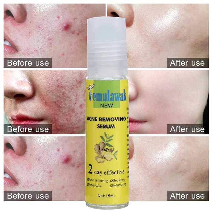 Temulawak Acne Removing Serum (Original) – Blemish &amp; Scar Treatment