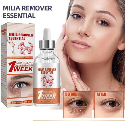 Smooth Milia Remover Serum 30ml – Clear Skin Treatment