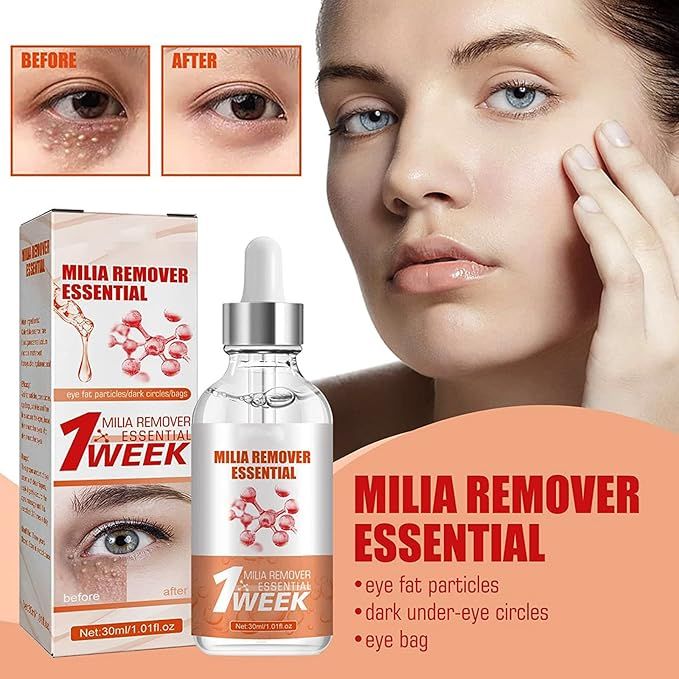 Smooth Milia Remover Serum 30ml – Clear Skin Treatment