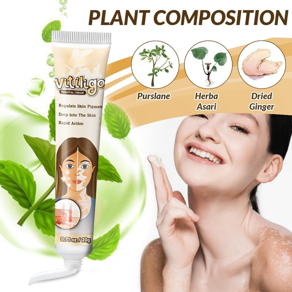 Vitiligo Removal Cream – Skin Tone Correcting Treatment