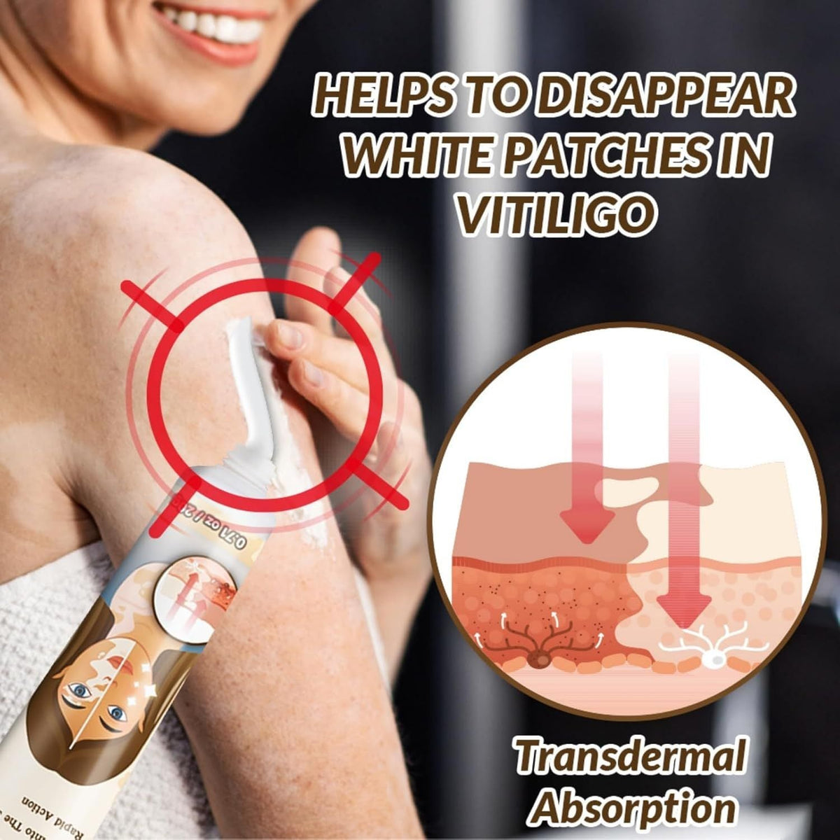 Vitiligo Removal Cream – Skin Tone Correcting Treatment