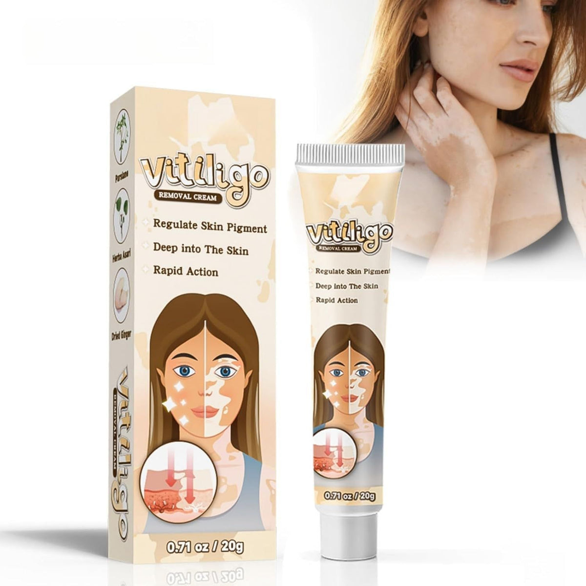 Vitiligo Removal Cream – Skin Tone Correcting Treatment