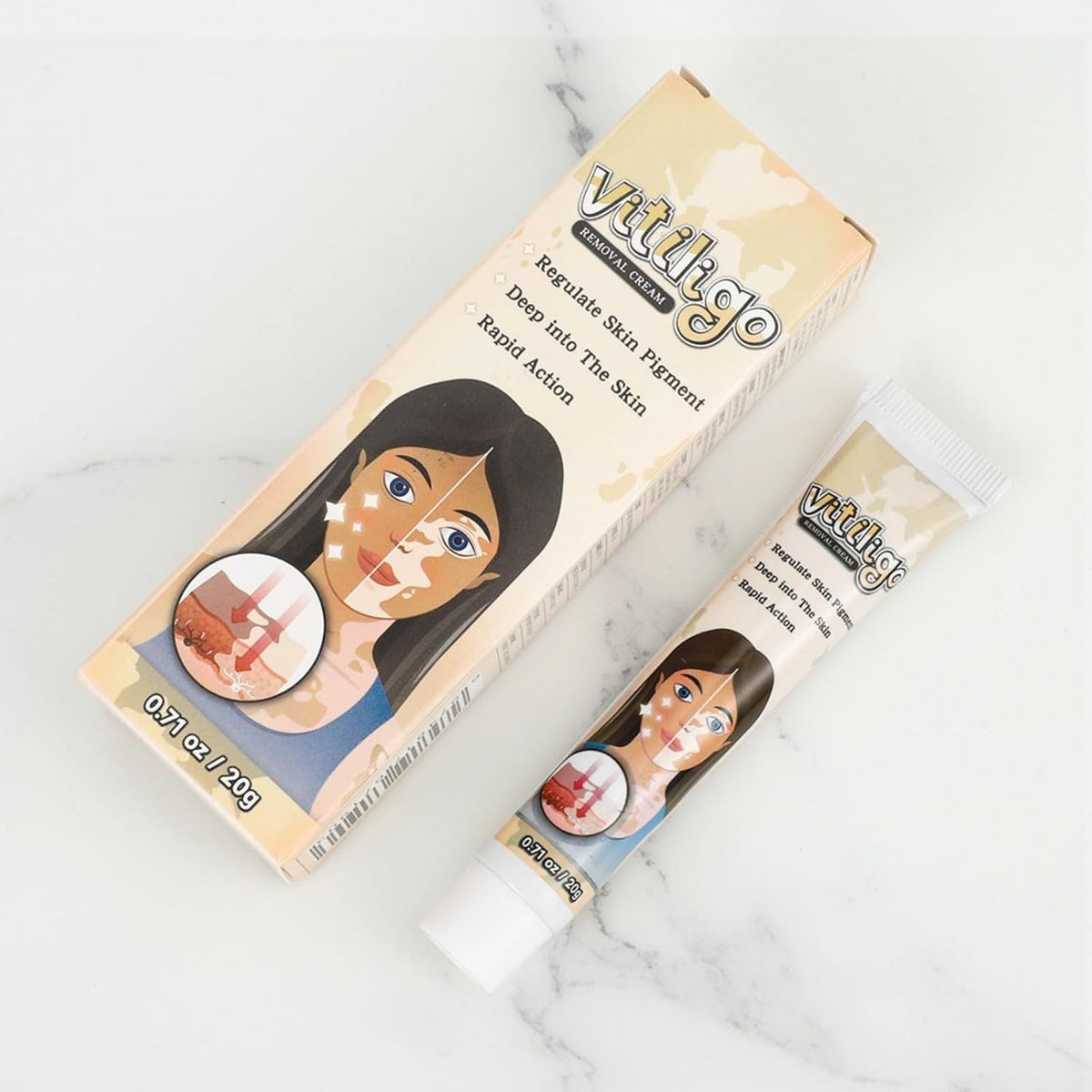 Vitiligo Removal Cream – Skin Tone Correcting Treatment