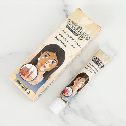 Vitiligo Removal Cream – Skin Tone Correcting Treatment